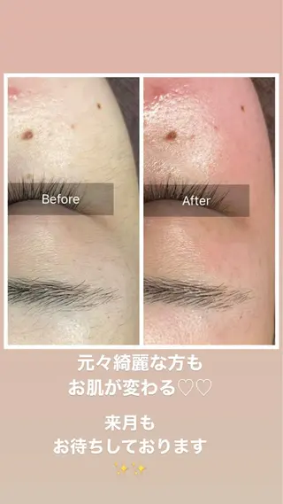 産毛専門店 Bittoのエステ・リラクイメージ