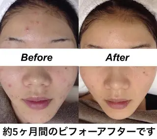 都度払い肌質改善 &脱毛Blancheのエステ・リラクイメージ