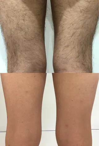 脱毛専門サロンElixir所属・脱毛専門サロン Elixirのエステ・リラクイメージ