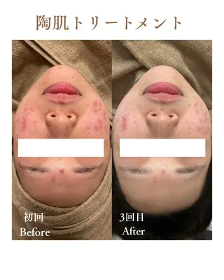 フェイシャルサロンLusis所属・肌質改善専門サロン Lusisのエステ・リラクイメージ