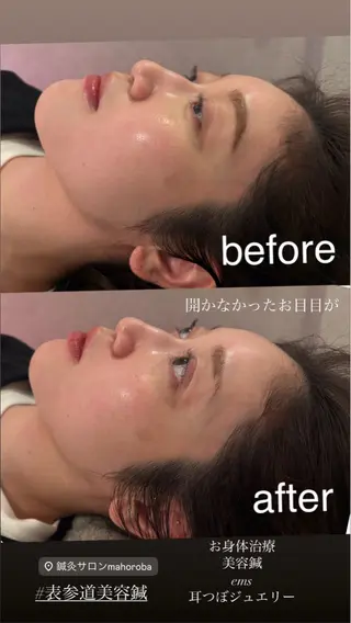 美容鍼灸サロン mahoroba院長のエステ・リラクイメージ