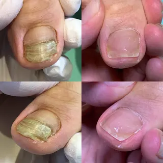 ネイル 東京巻き爪アカデミー所属・東京巻き爪 アカデミーのエステ・リラクイメージ