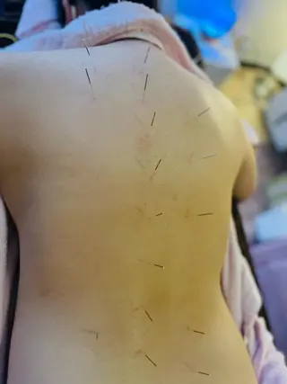 アロマ･美容鍼･カッ ピング「麗」鍼灸院のエステ・リラクイメージ