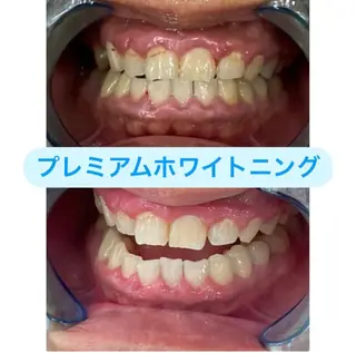 プラチナムビューティー柏所属・【歯科提携】柏ホワイ トニングスタイルのその他イメージ