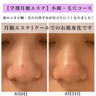 Bellesthe (ベルエステ)のエステ・リラクイメージ