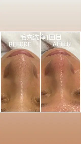 毛穴洗浄・痩身・脱毛 /アルカンジュのエステ・リラクイメージ