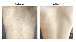 ニキビ、痩身、脱毛、 サクラチャンスパのエステ・リラクイメージ