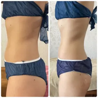 FLEUR大阪・整体 ・ハイフ・痩身・小顔のエステ・リラクイメージ