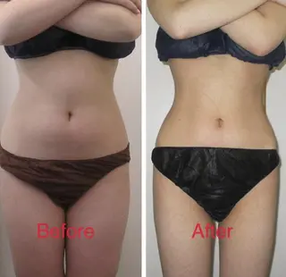 BELINDA銀座店 ✨痩身エステサロン✨のエステ・リラクイメージ