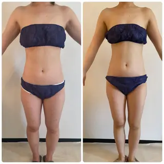 FLEUR大阪・整体 ・ハイフ・痩身・小顔のエステ・リラクイメージ