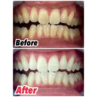 ヘアアレンジ メンズ プラチナムビューティー柏所属・【歯科提携】柏ホワイ トニングスタイルのその他イメージ