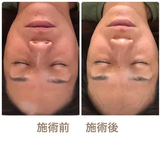 FLEUR大阪・美容 整体・痩身・小顔のエステ・リラクイメージ