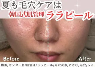 sii センター北 AIのエステ・リラクイメージ