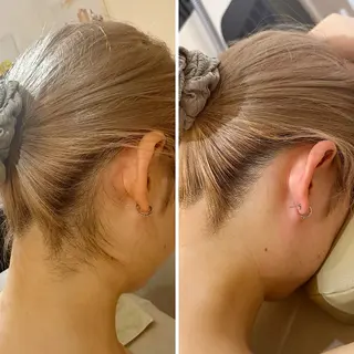 うなじ脱毛/美肌脱毛 LABELのエステ・リラクイメージ