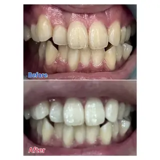 MBEAUTYSALON 千葉店・京成大久保所属・Melty 輝のその他イメージ