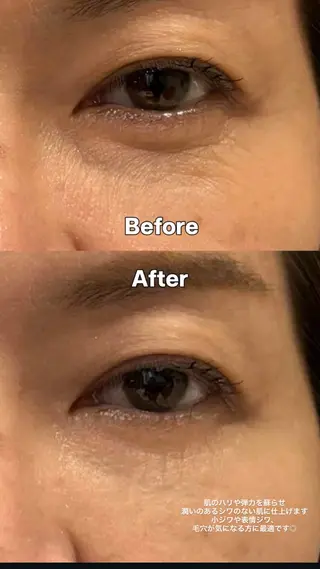 韓国式美人肌育成/美肌WAXサロン【L_style.】所属・【L_style.】 エルスタイルのエステ・リラクイメージ