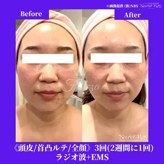 メンズ 有人型セルフサロン 脱毛/痩身/美顔のその他イメージ