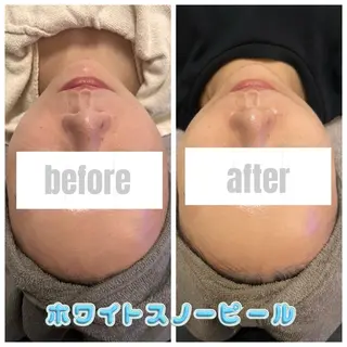 本気で痩せたい方へ 痩身専門サロンのその他イメージ