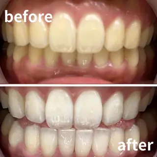 LBSホワイトニング 銀座店💎スタッフ峯のその他イメージ