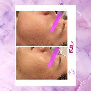 ☆痩身/小顔☆ 結果出します☆のエステ・リラクイメージ