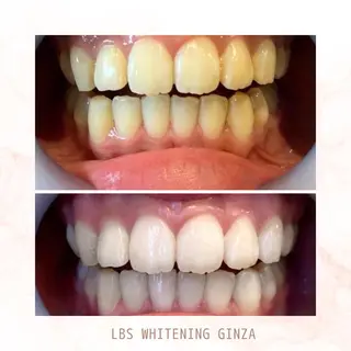 メンズ LBSホワイトニング 銀座店💎店長浦和のその他イメージ