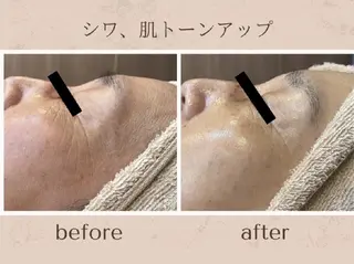 アンダブル 鴨井のエステ・リラクイメージ