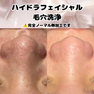 Diailes 💎ななのエステ・リラクイメージ