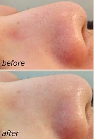 ANRIRE (アンリール)のエステ・リラクイメージ