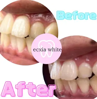 ecxia  white 　広島袋町店所属・セルフホワイトニング エクシア広島袋町店のその他イメージ