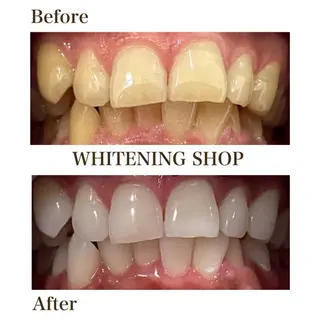 メンズ ホワイトニングショップ静岡葵区店所属・ホワイトニング ショップ静岡葵区店のその他イメージ