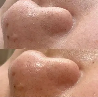 Embellir/ "Aine"🕊のマツエク・マツパデザイン