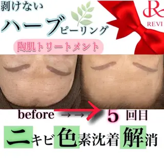 laluna saki...のその他イメージ