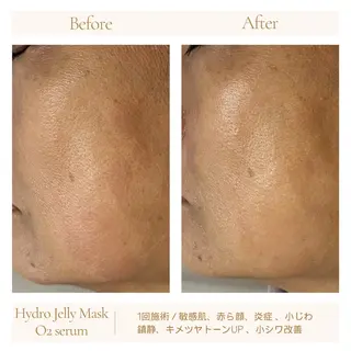 1ヶ月後も半分残る 高持続LEDエクステのマツエク・マツパデザイン