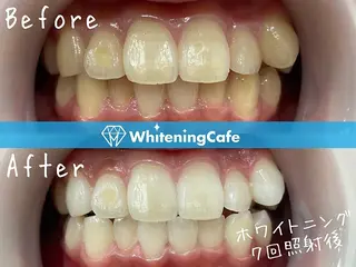 ホワイトニングカフェ中野店所属・ホワイトニングカフェ 中野店のその他イメージ