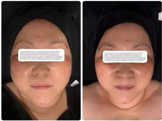 mi yuのエステ・リラクイメージ