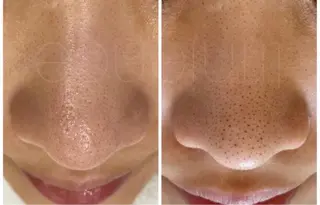 SINCERELY シンシアリー🌈のマツエク・マツパデザイン