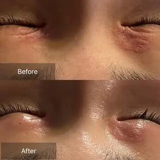 Mandarin Orange所属・毛穴から始める肌メン テマンダリンオレンジのエステ・リラクイメージ