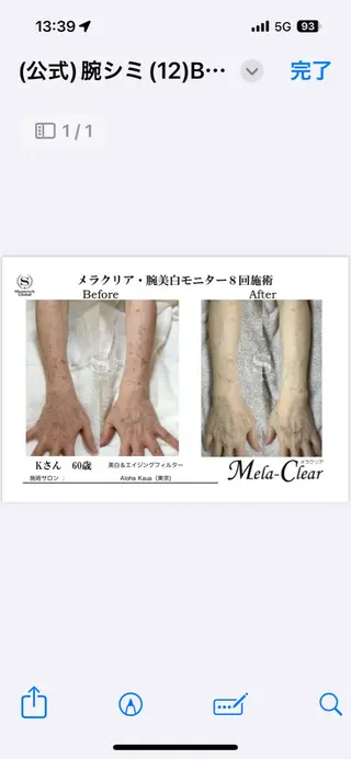 光美容シャムロック バスト、シミ専門店のエステ・リラクイメージ