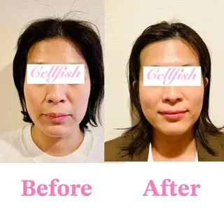 Cellfish ~セルフィッシュ~のエステ・リラクイメージ