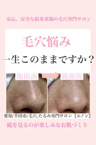 毛穴.たるみ専門店 Lunonのエステ・リラクイメージ