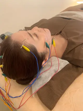 新宿hari-me所属・美容鍼hari-me 新宿のエステ・リラクイメージ