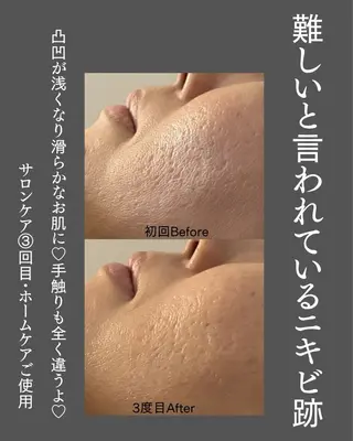 BLOSSOM 菊地のエステ・リラクイメージ