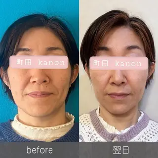 小顔矯正サロン町田 逸見智美のエステ・リラクイメージ