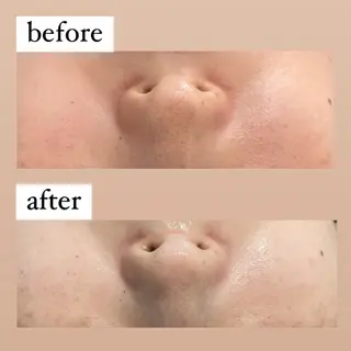 crescent所属・【韓国肌管理・脱毛】 クレセントのエステ・リラクイメージ