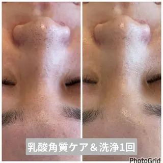 薮 愛のエステ・リラクイメージ