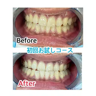 メンズ プラチナムビューティー柏所属・【歯科提携】柏ホワイ トニングスタイルのその他イメージ