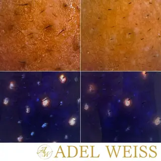 毛穴ケア＆脱毛サロン　ADEL WEISS所属・毛穴ケア＆脱毛サロン ADEL　WEISSのエステ・リラクイメージ