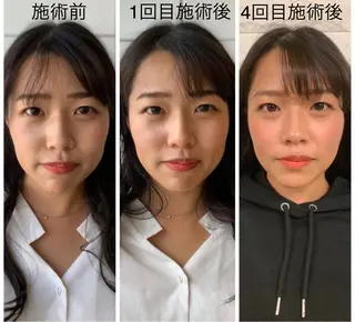 小顔・美肌専門 天六駅徒歩1分のエステ・リラクイメージ