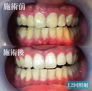 ヘアアレンジ メンズ ネイル マツエク・マツパ アイブロウ LBSホワイトニング 銀座店💎公式のその他イメージ