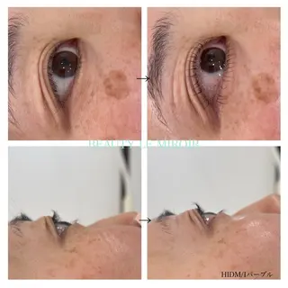 マツエク・マツパ ビューティー ミロワールのエステ・リラクイメージ